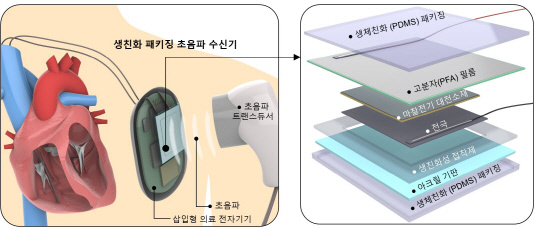 KIST가 개발한 생체 친화적 초음파 수신기 개념도 및 내부 구성도.